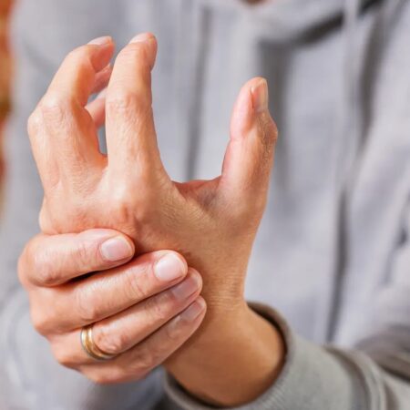 Rheumatoid Arthritis (RA): Causes, Symptoms, Treatment & Prevention
