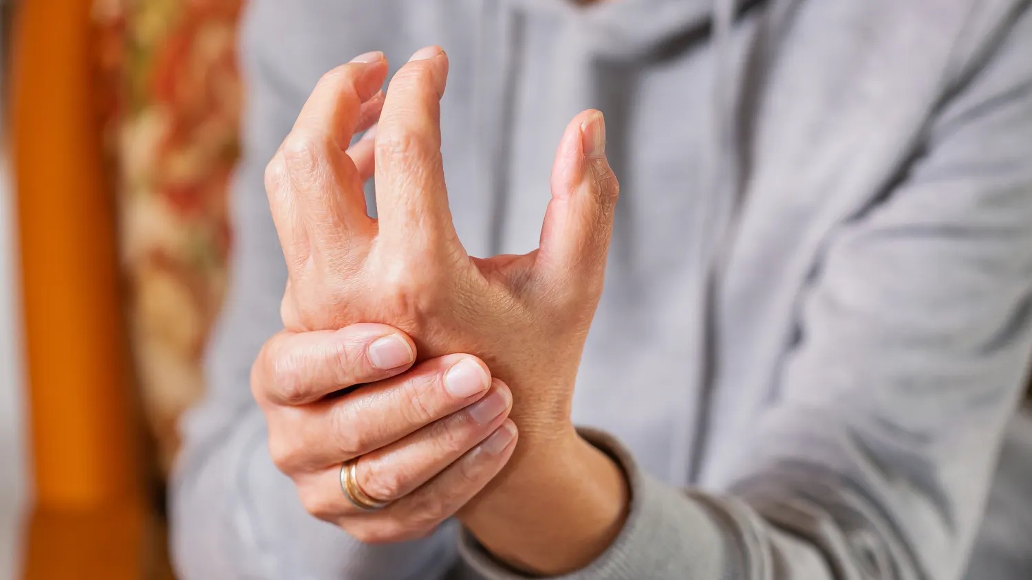 Rheumatoid Arthritis (RA): Causes, Symptoms, Treatment & Prevention